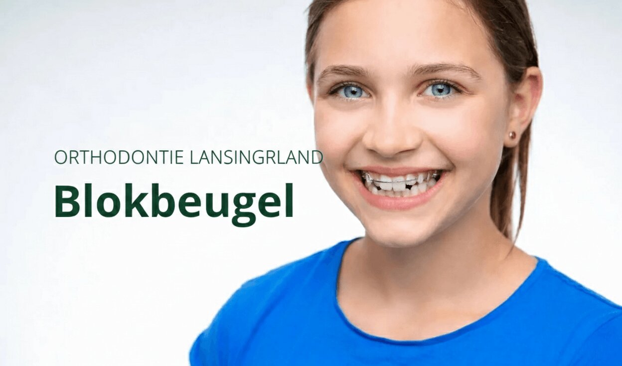 Blokbeuge Blokbeugel-activator-kleuren